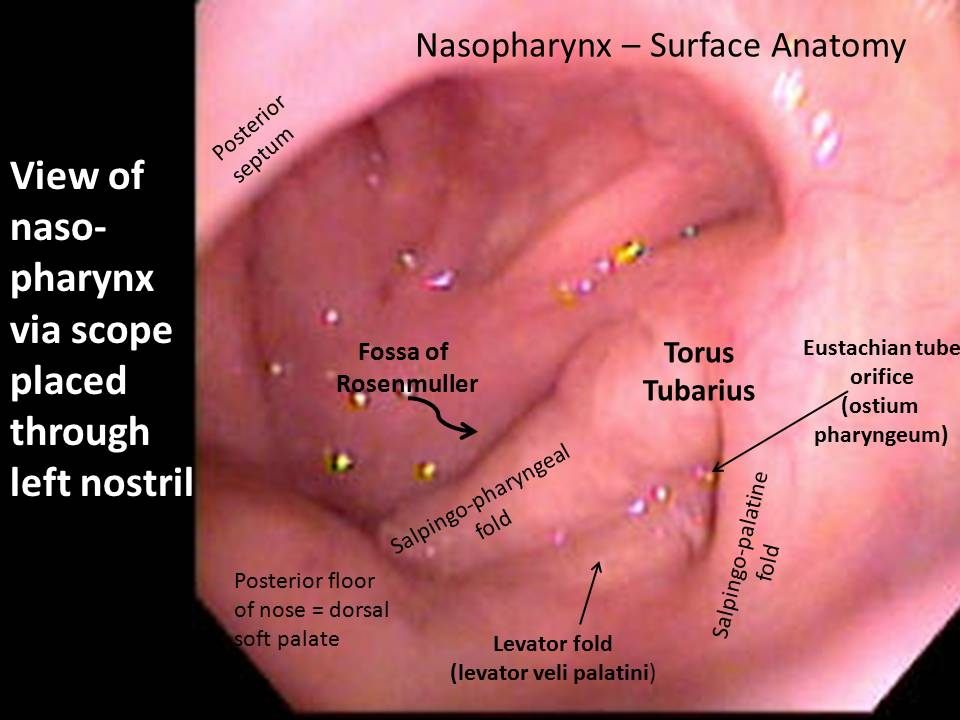 Flexible Fiberoptic Laryngoscopy written Instruction 