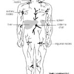Lymph System Hodgkin Disease