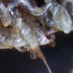 Morgellons Disease Is Not A Delusion Says New Study