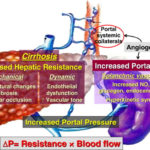 The Management Of Portal Hypertension Rational Basis