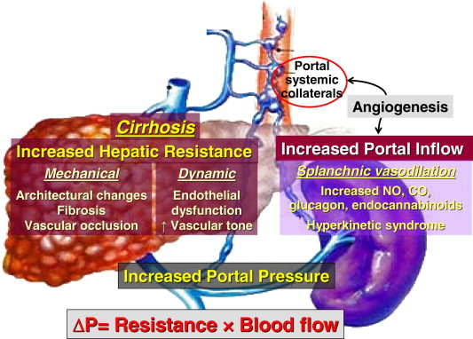 The Management Of Portal Hypertension Rational Basis 