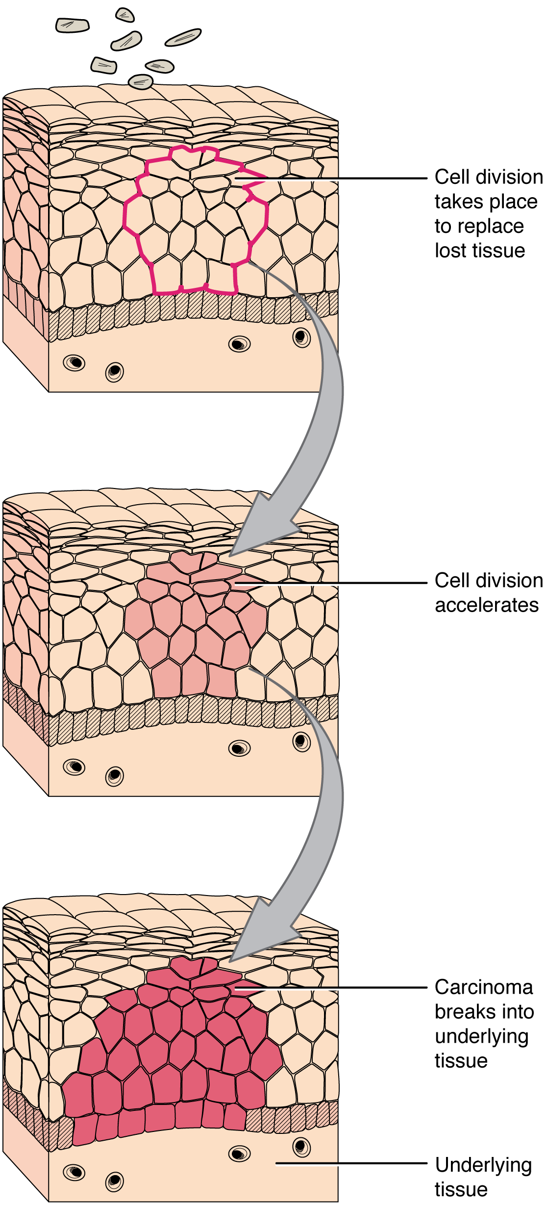 This Series Of Three Diagrams Shows The Development Of 