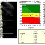 CP Advanced Imaging Bone Densitometry