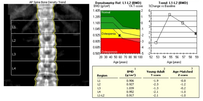 CP Advanced Imaging Bone Densitometry