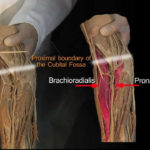 Cubital Fossa Anatomy Tutorial YouTube