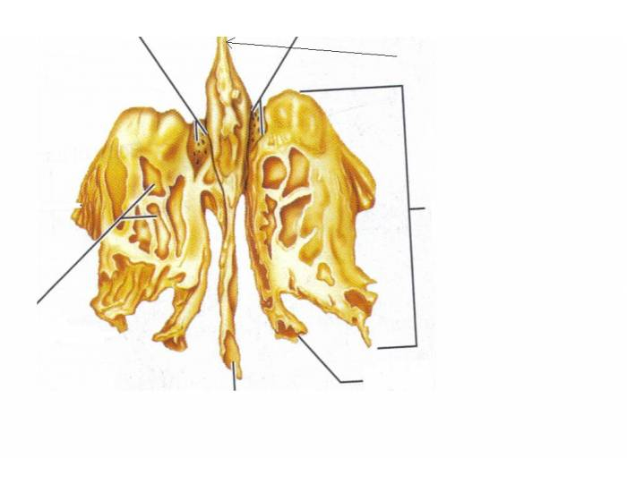 Ethmoid Bone Quiz