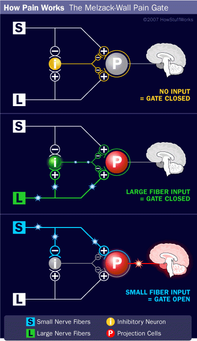 Gate Control Theory Of Pain HowStuffWorks