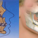 Orthognathic Surgery MIDAC