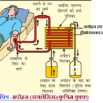 Dialysis Or Hemodialysis In Hindi NCERT SCIENCE IN HINDI