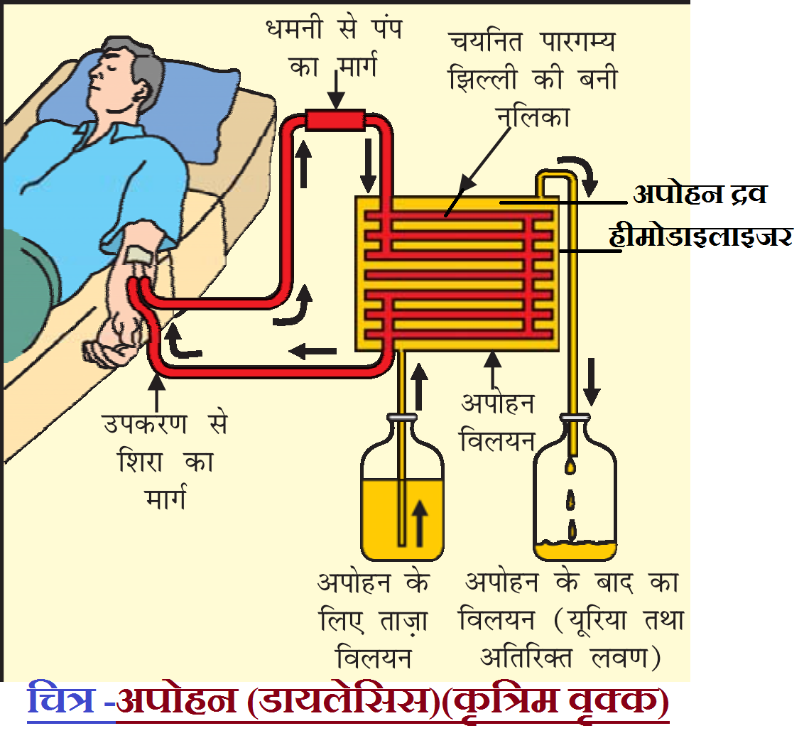 Dialysis Or Hemodialysis In Hindi NCERT SCIENCE IN HINDI